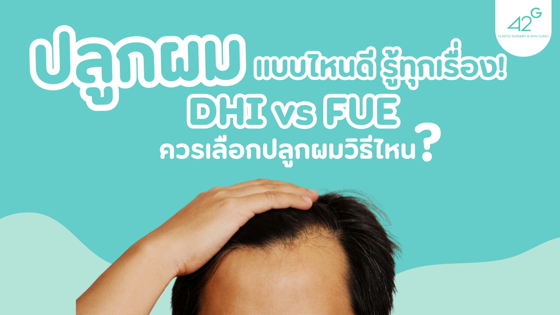 ปลูกผม แบบไหนดี รู้ทุกเรื่อง! DHI vs FUE ควรเลือกปลูกผมวิธีไหน