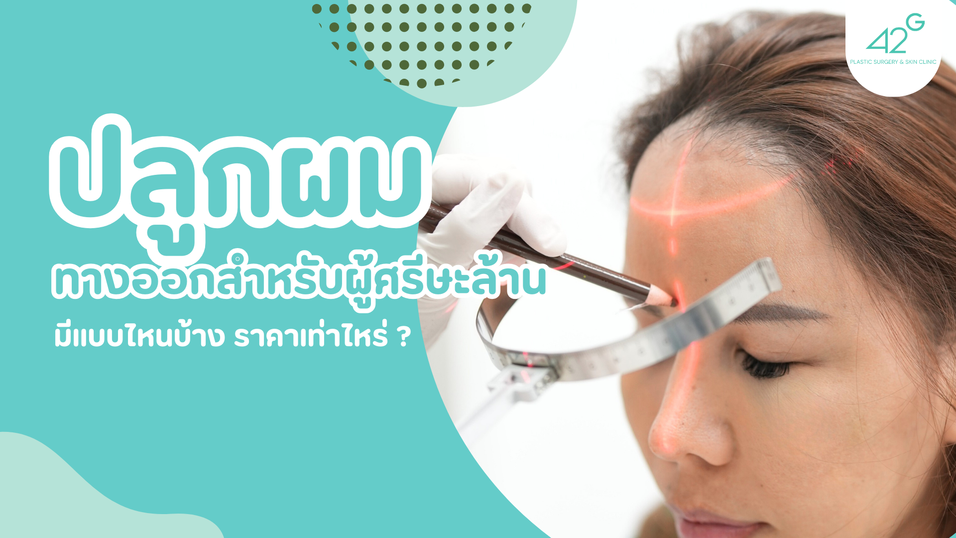 ปลูกผม ทางออกสำหรับผู้ศรีษะล้าน มีแบบไหนบ้าง ราคาเท่าไหร่